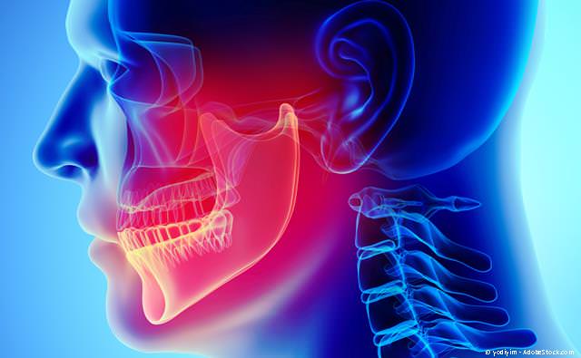 Hilfe bei Zähneknirschen und Kiefergelenksproblemen