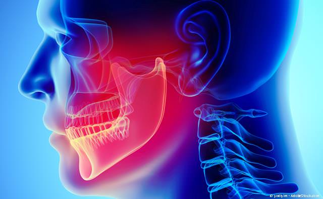 Hilfe bei Zähneknirschen und Kiefergelenkknacken